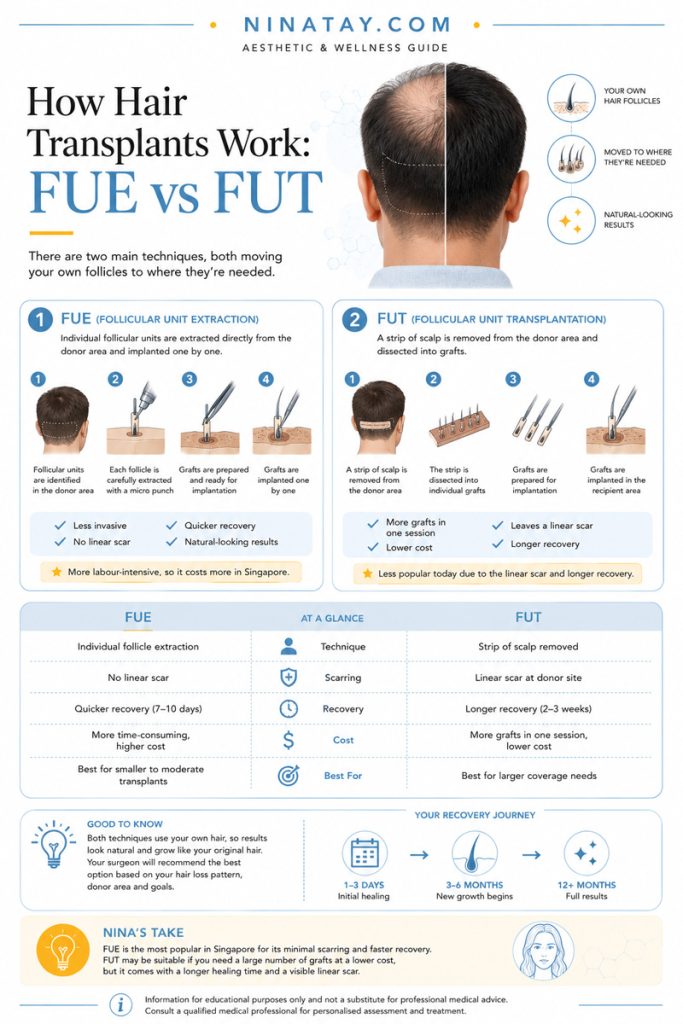 hair transplant singapore