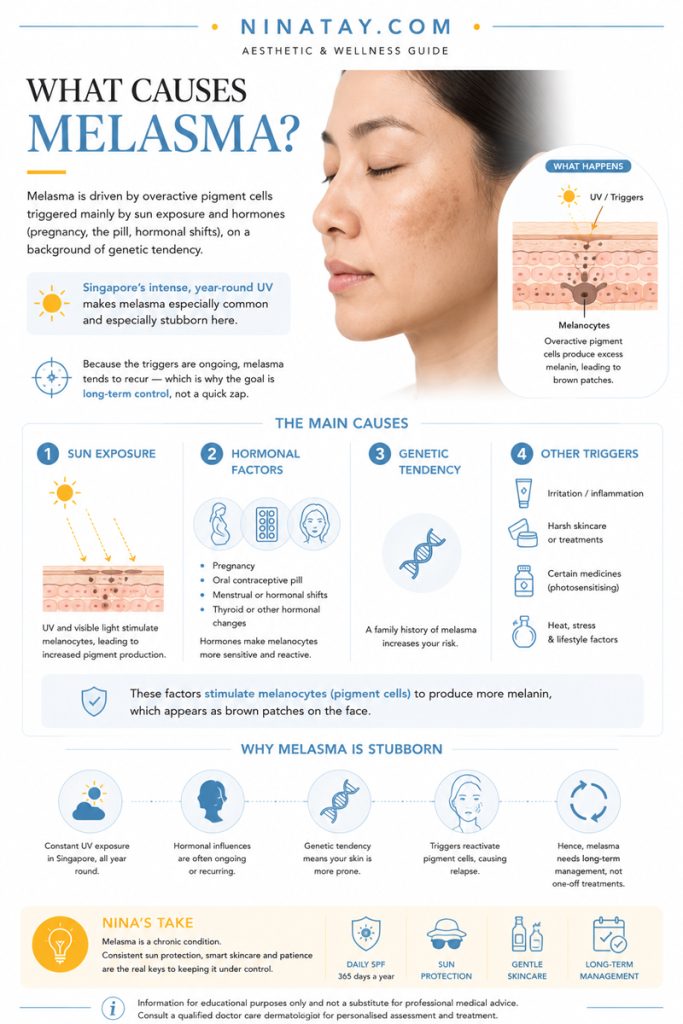 melasma treatment singapore